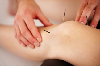 Acupuncture Technique